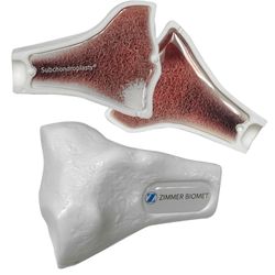 Image of ZB14001 SCP White Knee Patient Education Demo Model
