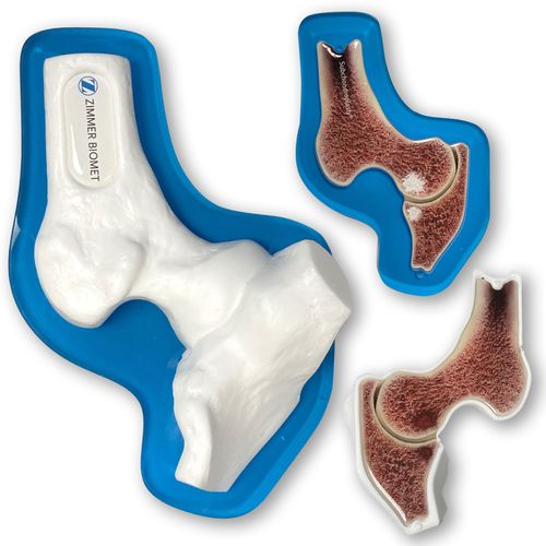 ZB14003 SCP White Hip Patient Education Demo Model image thumbnail