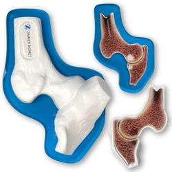 Image of ZB14003 SCP White Hip Patient Education Demo Model